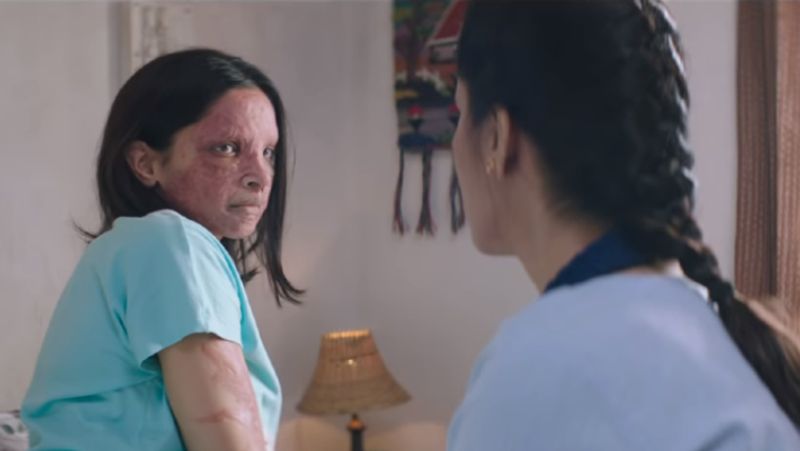 Chhapaak Movie Trailer Deepika padukone look takes Prosthetic Makeup for Become Malti KPY