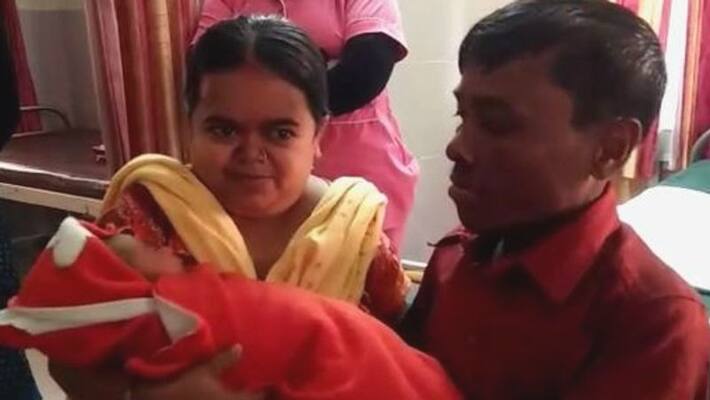 Finally dwarf couple get their first child Finally dwarf couple get their first child