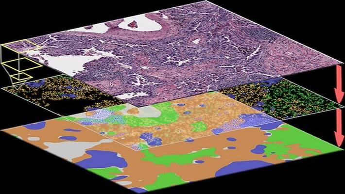 Research: Now cancer cells will be identified through Artificial Intelligence KPI Research: Now cancer cells will be identified through Artificial Intelligence KPI