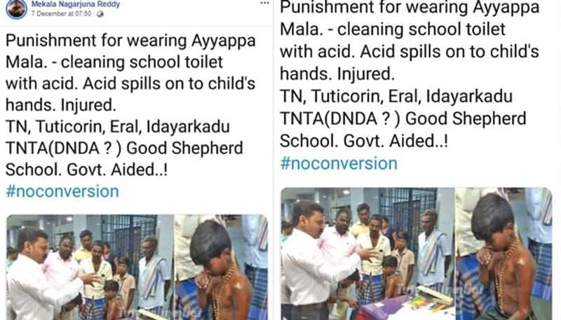 Image of boy with acid burns viral as child punished for wearing Ayyappa necklace in Tamil Nadu school