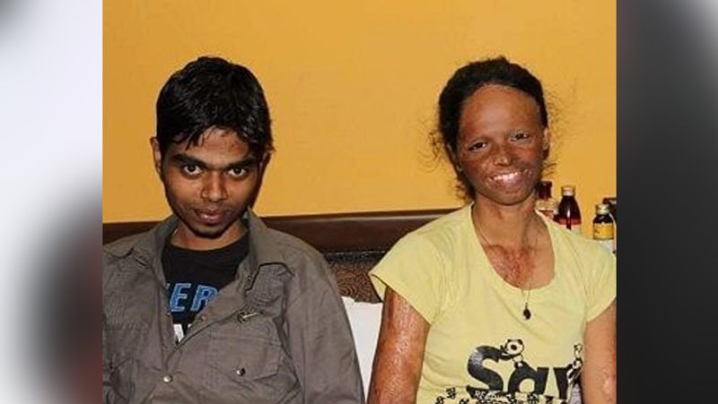 Rarely seen photos of chhapaak lead acid attack survivor laxmi Agarwal kph