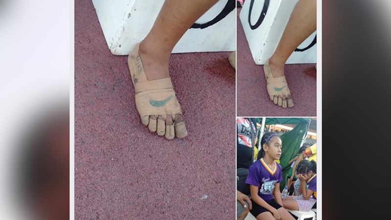 11 year old poor girl wins 3 gold medal wearing nike shoes made with surgical bandages kph