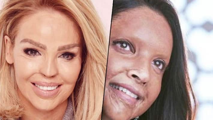 British activist Katie Piper goes gaga over Deepika Padukone's Chhapaak British activist Katie Piper goes gaga over Deepika Padukone's Chhapaak