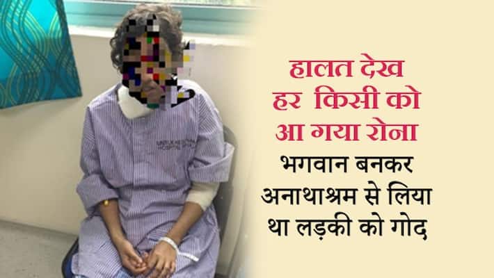 24 year old girl tortured by foster family with burns all over body kph 24 year old girl tortured by foster family with burns all over body kph