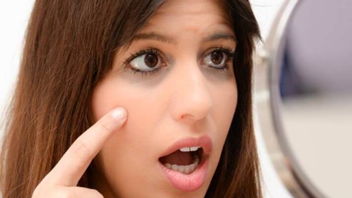 tips to get rid of dark circles tips to get rid of dark circles
