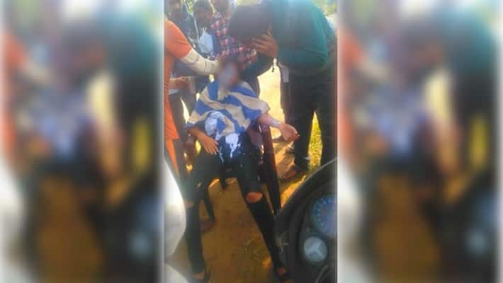 Acid attack on 20-year-old engineering student in Gondia district of Maharashtra kpa Acid attack on 20-year-old engineering student in Gondia district of Maharashtra kpa