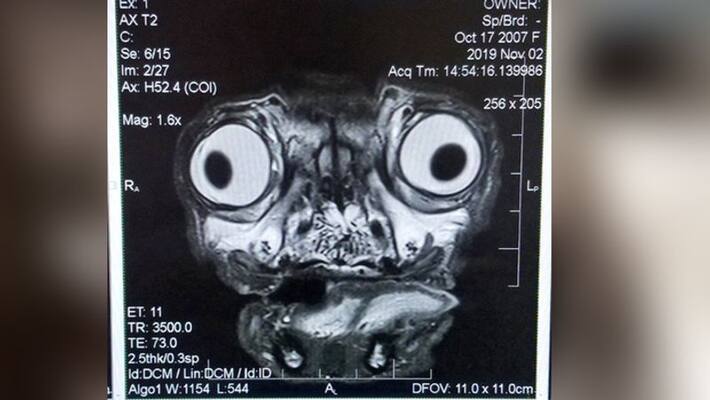 X ray report of pug face left people baffled kph X ray report of pug face left people baffled kph