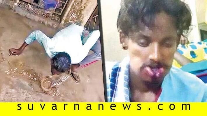 A man tried to kiss a cobra and bitten by the snake A man tried to kiss a cobra and bitten by the snake
