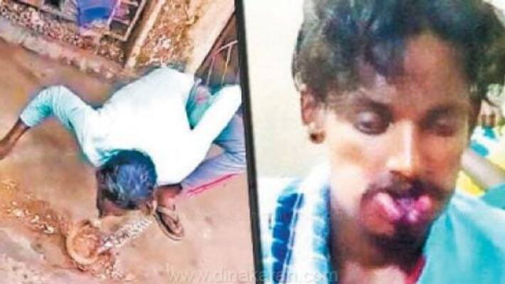 snake catcher got snake bite when he treat miss handling that snake at Bangalore snake catcher got snake bite when he treat miss handling that snake at Bangalore