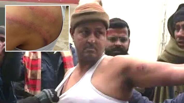allegations on amethi police to beaten rss worker KPU allegations on amethi police to beaten rss worker KPU
