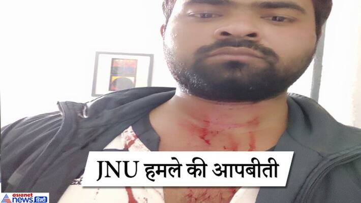 avbp acused Left student over Attacks on JNU, says they brutality beat us KPP avbp acused Left student over Attacks on JNU, says they brutality beat us KPP
