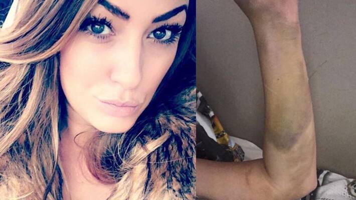 woman has revealed how she nearly died after taking the contraceptive pill caused her to have two huge blood clots woman has revealed how she nearly died after taking the contraceptive pill caused her to have two huge blood clots