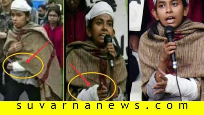 Fact Check No JNU Student Union President Aishe Ghosh Did not Fake Her Hand Injury Fact Check No JNU Student Union President Aishe Ghosh Did not Fake Her Hand Injury