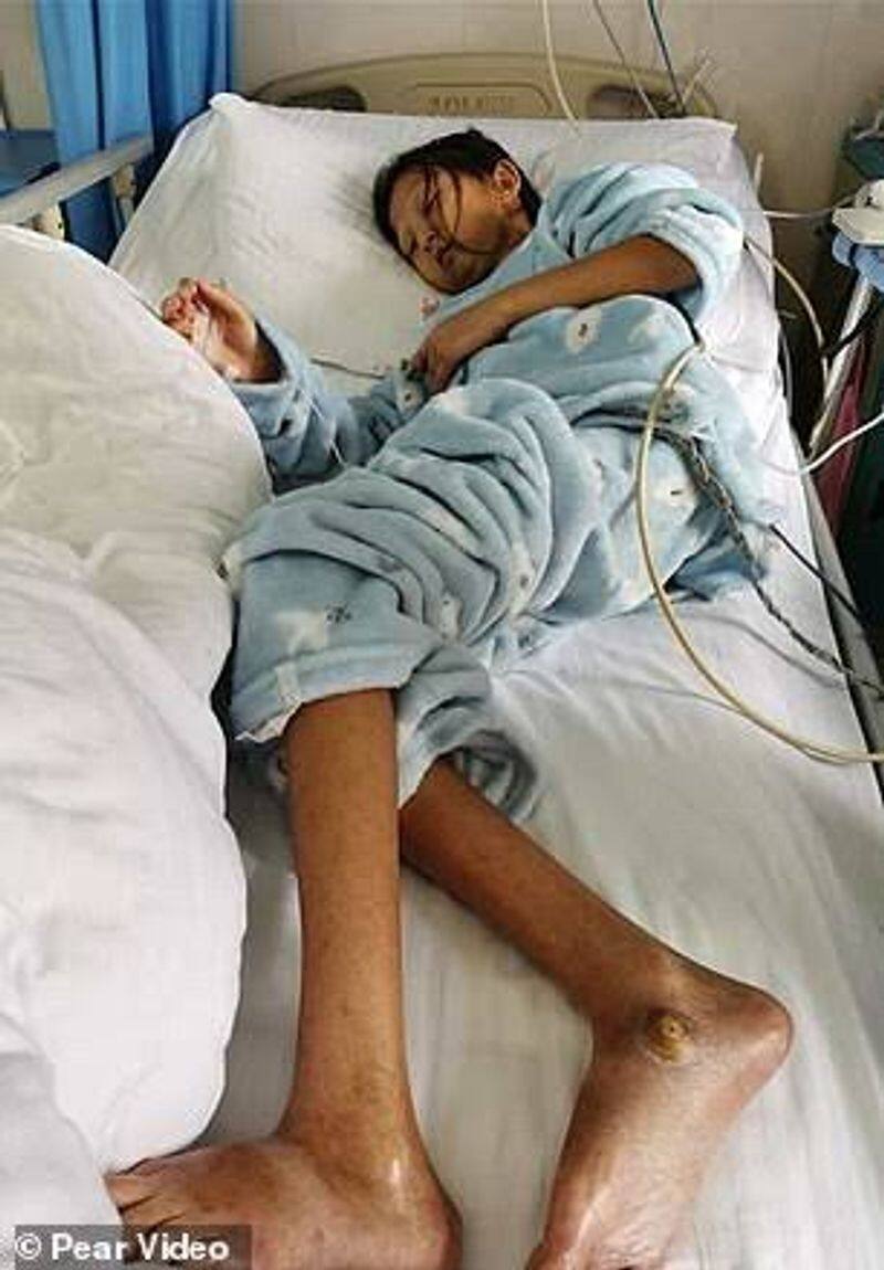Wu Huayan the chinese girl who starved for brothers treatment fund dies of malnutrition