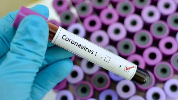 This Corona Virus is terrific than Sars Virus This Corona Virus is terrific than Sars Virus