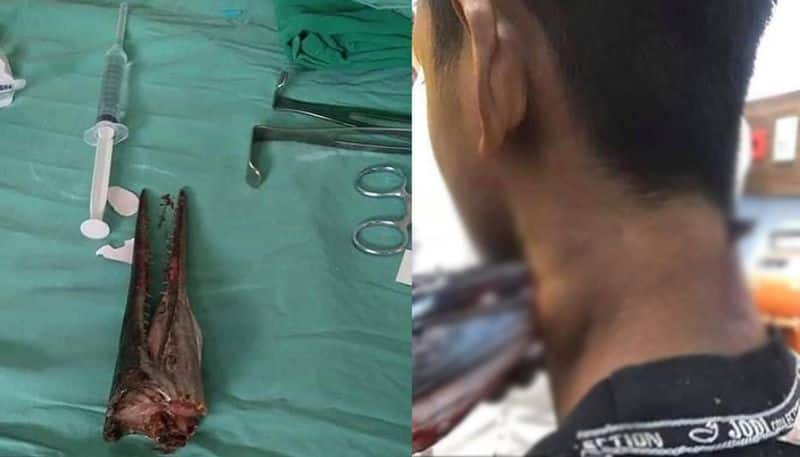 Teenage boy seriously injured after needle fish piercing through back of neck