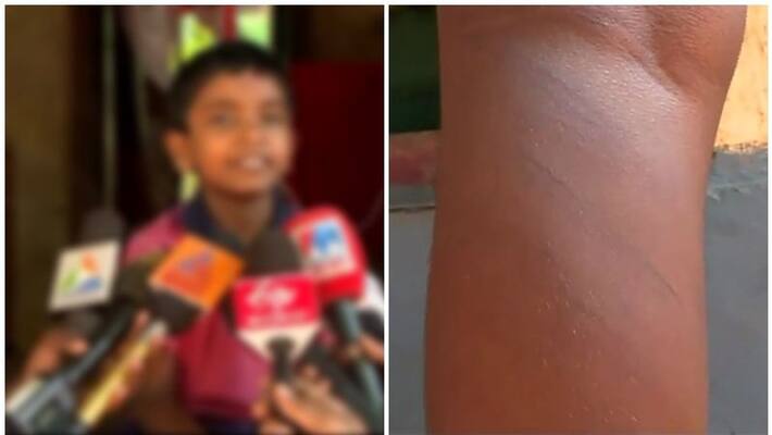 student beaten by teacher at kottayam student beaten by teacher at kottayam