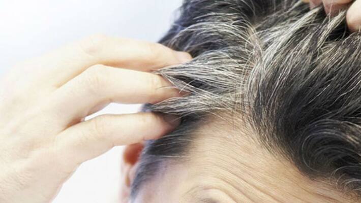 stress may be a reason for greying of hair stress may be a reason for greying of hair