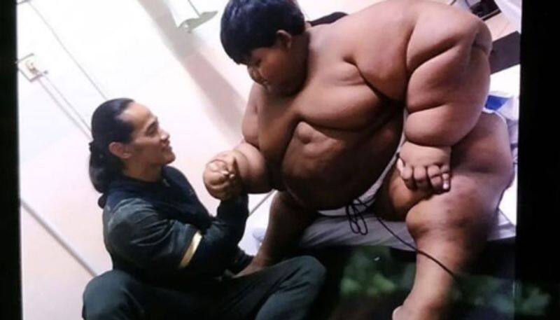 worlds fattest child reduced his body weight