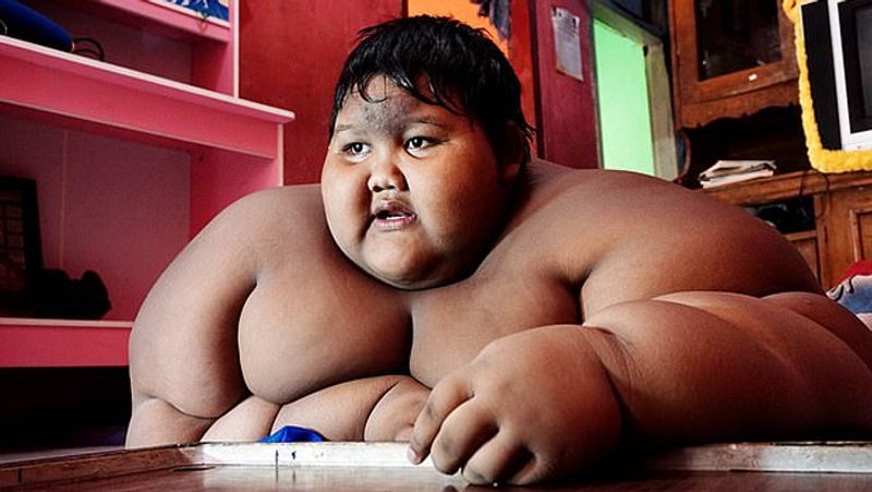 how 190 worlds fattest boy arya permana loss 170 to 83 kg weight loss story