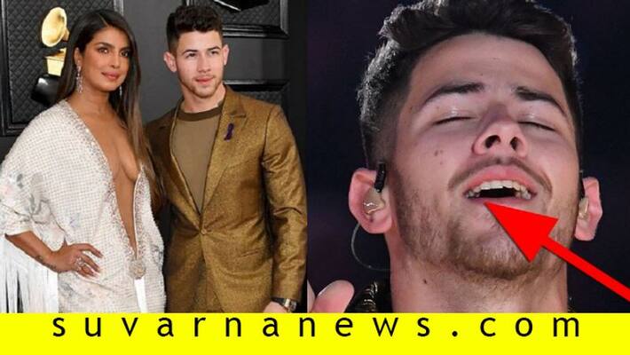 Nick jonas stuns Internet with food stuck teeth in grammy 2020 Nick jonas stuns Internet with food stuck teeth in grammy 2020