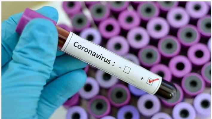 CORONAVIRUS CENTRAL GOVERNMENT FORMS SPECIAL TASK FORCE INCLUDING MINISTERS TO COMBAT CORONAVIRUS CENTRAL GOVERNMENT FORMS SPECIAL TASK FORCE INCLUDING MINISTERS TO COMBAT