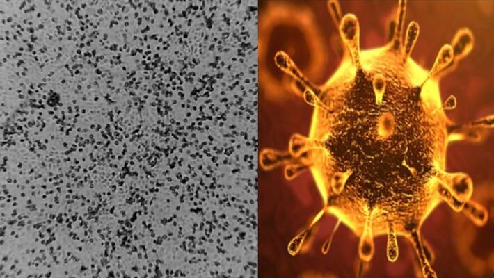 oronavirus virus that killed China ..! Chinese people in tragedy! oronavirus virus that killed China ..! Chinese people in tragedy!
