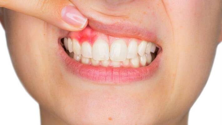 high blood sugar can identify by these symptoms high blood sugar can identify by these symptoms