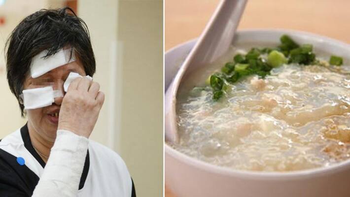Hot tempered man throws hot daliya on woman as she served half cooked egg kph Hot tempered man throws hot daliya on woman as she served half cooked egg kph