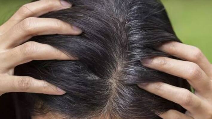 home remedies for grey hair home remedies for grey hair