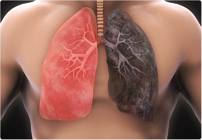 Foods that keep your lungs healthy which usually harm by pollution