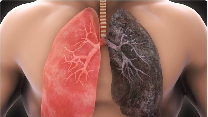Corona virus risk for smokers Corona virus risk for smokers