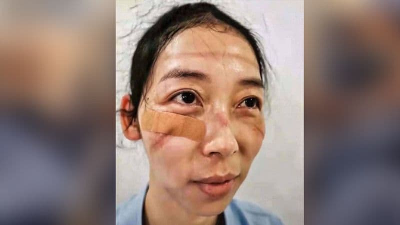 चीन में कई ऐसे डॉक्टर्स हैं जो पिछले कई हफ़्तों से लगातार बिना छुट्टी लिए मरीजों का ट्रीटमेंट कर रहे हैं।