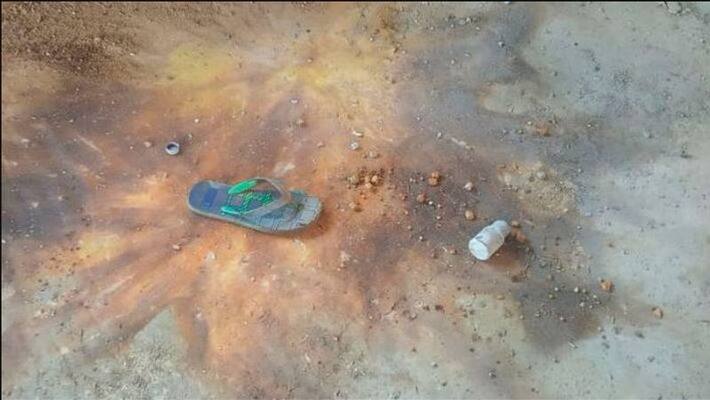 TMC leader loses both hands after blast in Parui TMC leader loses both hands after blast in Parui