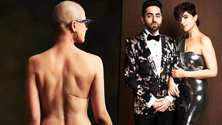 World Cancer Day: Ayushmann Khurrana's wife Tahira Kashyap shares her battle with breast cancer World Cancer Day: Ayushmann Khurrana's wife Tahira Kashyap shares her battle with breast cancer