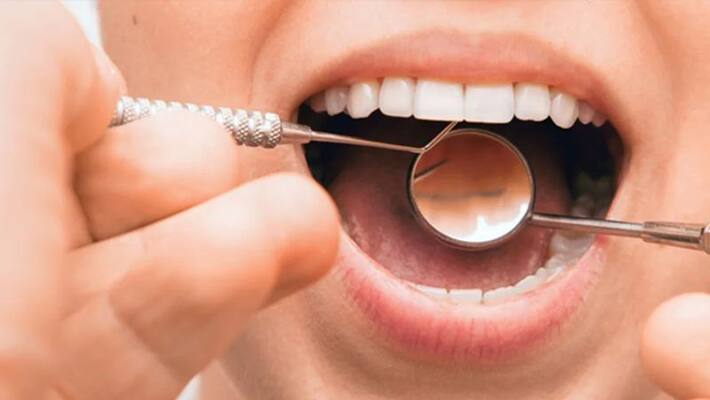 Doctors in Bihar remove 82 teeth of teenager with rare tumour bpsb Doctors in Bihar remove 82 teeth of teenager with rare tumour bpsb