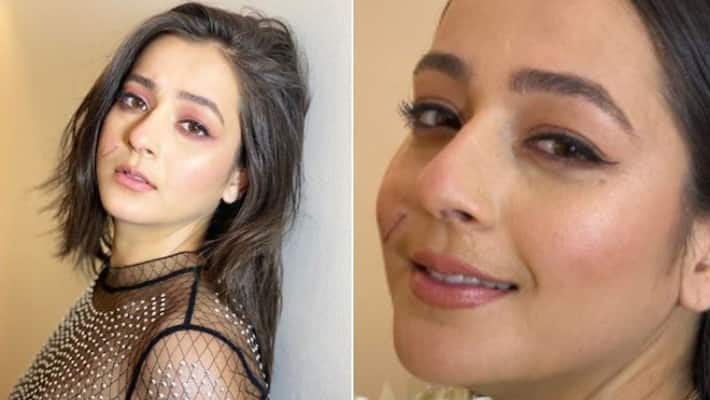 priyal gor posted mysterious photo that her mouth skin stiched priyal gor posted mysterious photo that her mouth skin stiched