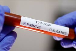 Coronavirus pandemic: As deaths soar, WHO says vaccination will take another 12 to 18 months