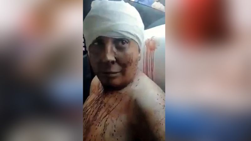 जब एरिक से ऐसा करने का कारण पूछा गया तो उसने बताया कि वो किसी को नहीं बताना चाहता कि उसने इंग्रिड को क्यों मारा? फिलहाल पुलिस पूरे मामले की जांच कर रही है।