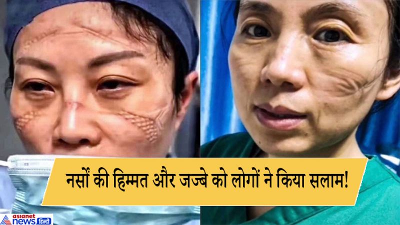 दुनियाभर में कोरोना वायरस की दहशत फैली हुई है पर चीन में डॉक्टर और नर्से अपनी ड्यूटी को निभाते हुए लोगों की जान बचाने में लगे हैं। खतरनाक चिकित्सा आपात स्थितियों में भी चीन में डॉक्टर और नर्स लगातार दिन-रात काम कर रहे हैं। इलाज के दौरान उन्हें मास्क लगाकार रोगियों की देखभाल करनी पड़ रही है।