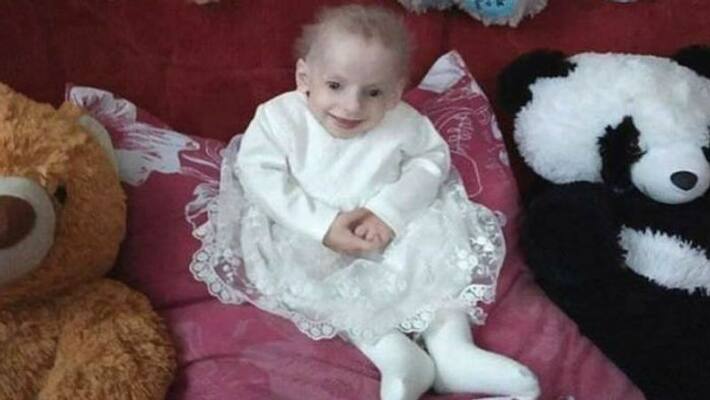 eight year old girl died of rarest disease progeria eight year old girl died of rarest disease progeria