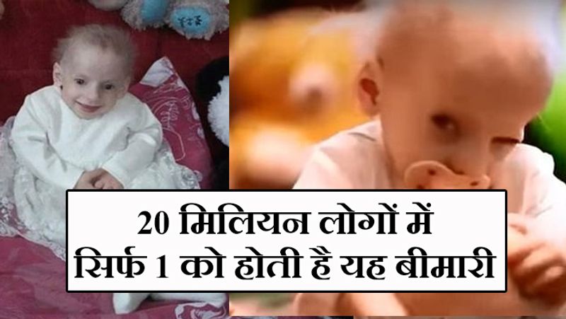 टिमफोय नैगोर्नी नाम की संस्था ने इस बच्ची के इलाज का खर्च उठाया। संस्था के अनुसार बच्ची चाहती थी कि एक दिन डॉक्टर गलत साबित हों और वो स्वस्थ्य जीवन जी सके।