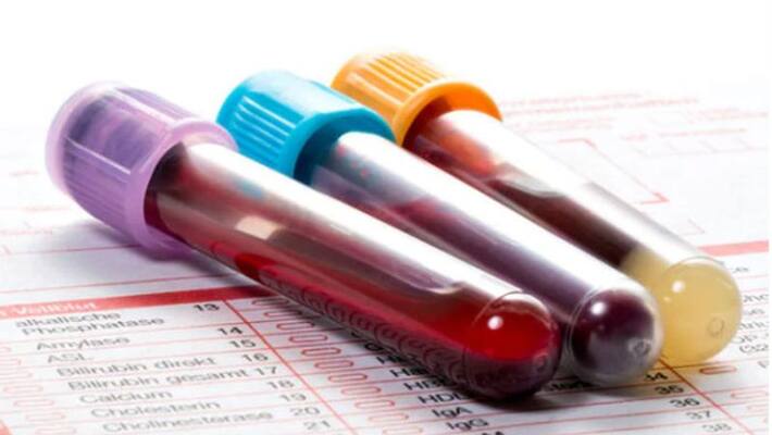 china release blood research report which group mostly affect by corona virus...? china release blood research report which group mostly affect by corona virus...?