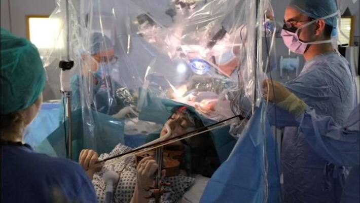 Woman plays violin as doctors perform brain surgery to Her, watch the viral video Woman plays violin as doctors perform brain surgery to Her, watch the viral video