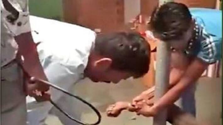 Petrol dipped screwdriver inserted into Dalit man tortured for theft in Jaipura Petrol dipped screwdriver inserted into Dalit man tortured for theft in Jaipura