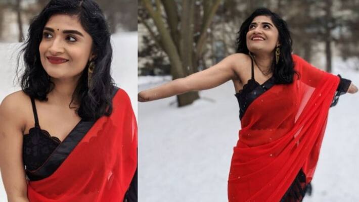 surgical error malvika iyer who lost hands in blast surgical error malvika iyer who lost hands in blast