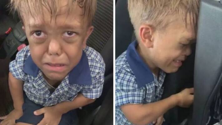 know about dwarfism which came in discussion after quaden bayles viral video know about dwarfism which came in discussion after quaden bayles viral video