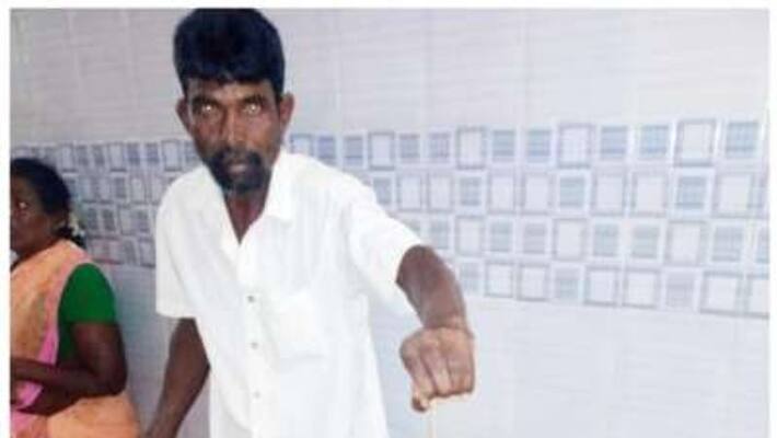 man came with snake to hospital which bitten him man came with snake to hospital which bitten him