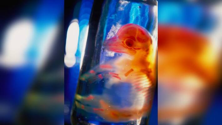 Jars Containing Human Tongues Dating Back 50 Years Found in Florida Hous Jars Containing Human Tongues Dating Back 50 Years Found in Florida Hous