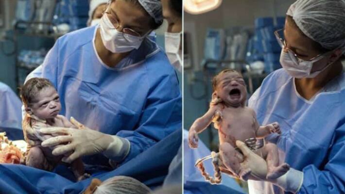Angry photo of newborn to make her cry before cutting her umbilical cord goes viral Angry photo of newborn to make her cry before cutting her umbilical cord goes viral